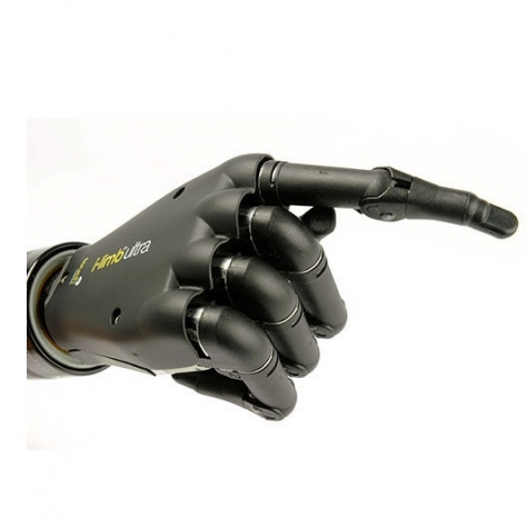 Mão biônica - Touch Bionics - I-Limb Quantum - Ossür