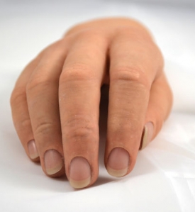 Silicones membros superiores